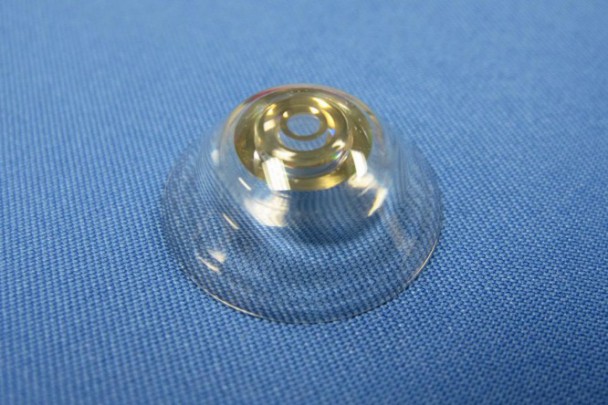 20150216a-zoomolasra-kepes-kontaktlencse